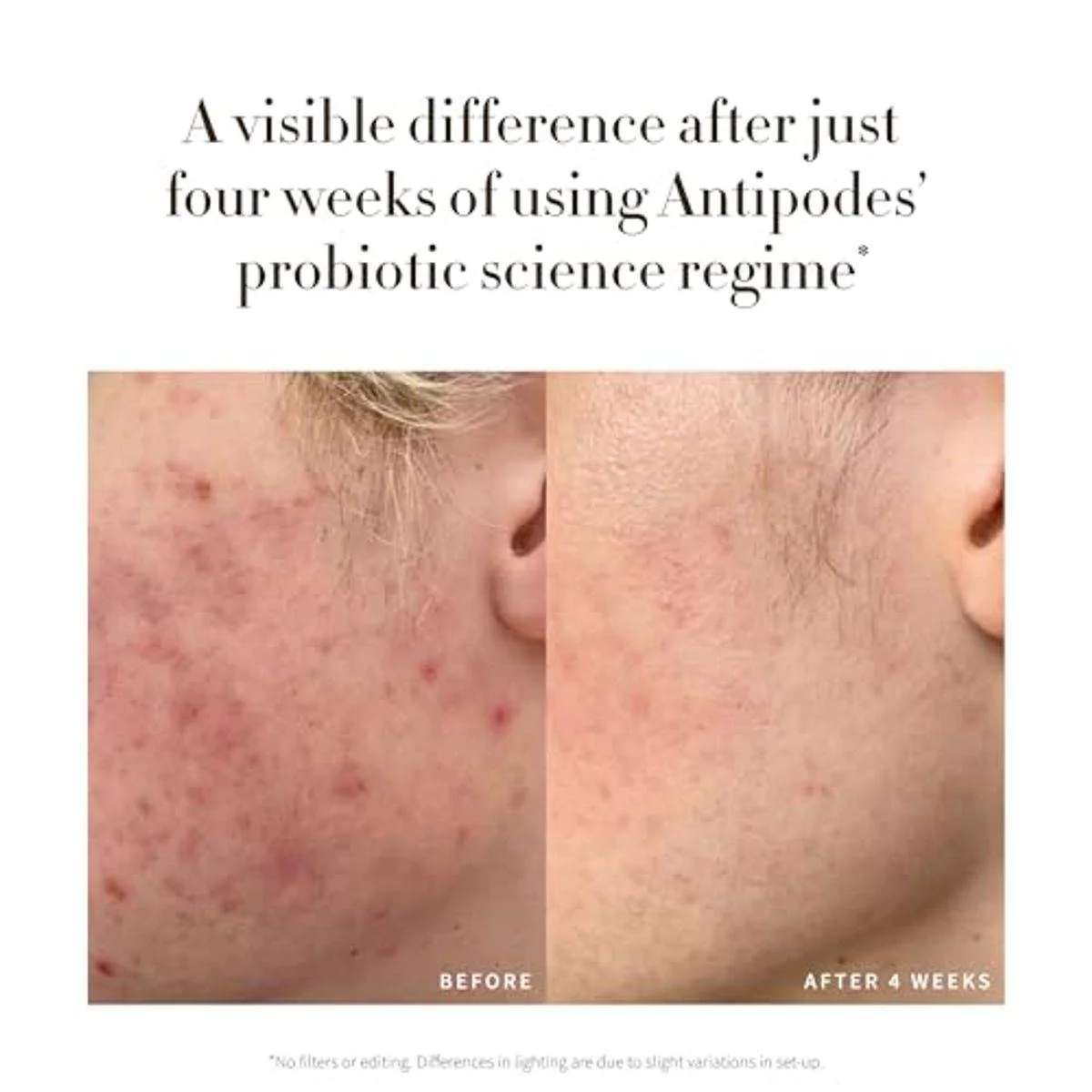 Antipodes Credo Probiotic Anti Blemish Serum 30ml - Image 5