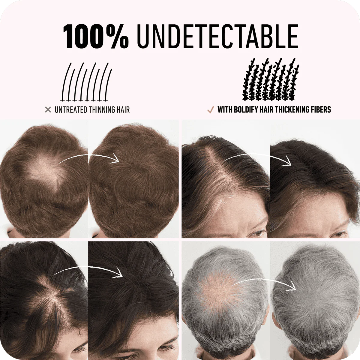 Boldify Hair Building Fiber Dark Brown 12g - Image 3