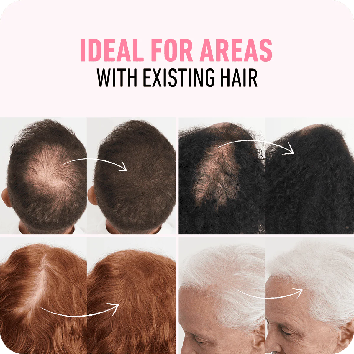 Boldify Hair Building Fiber Dark Brown 12g - Image 4
