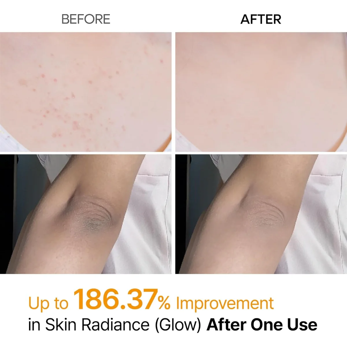 Dr. Melaxin Peel Shot Exfoliating Kojic Acid Turmeric Spray 200ml - Image 4