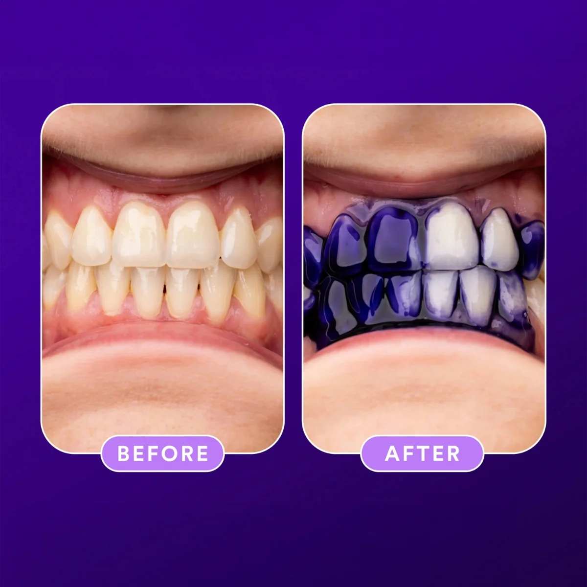 Hismile V34 Teeth Whitening Colour Corrector Toothpaste 100g - Image 4