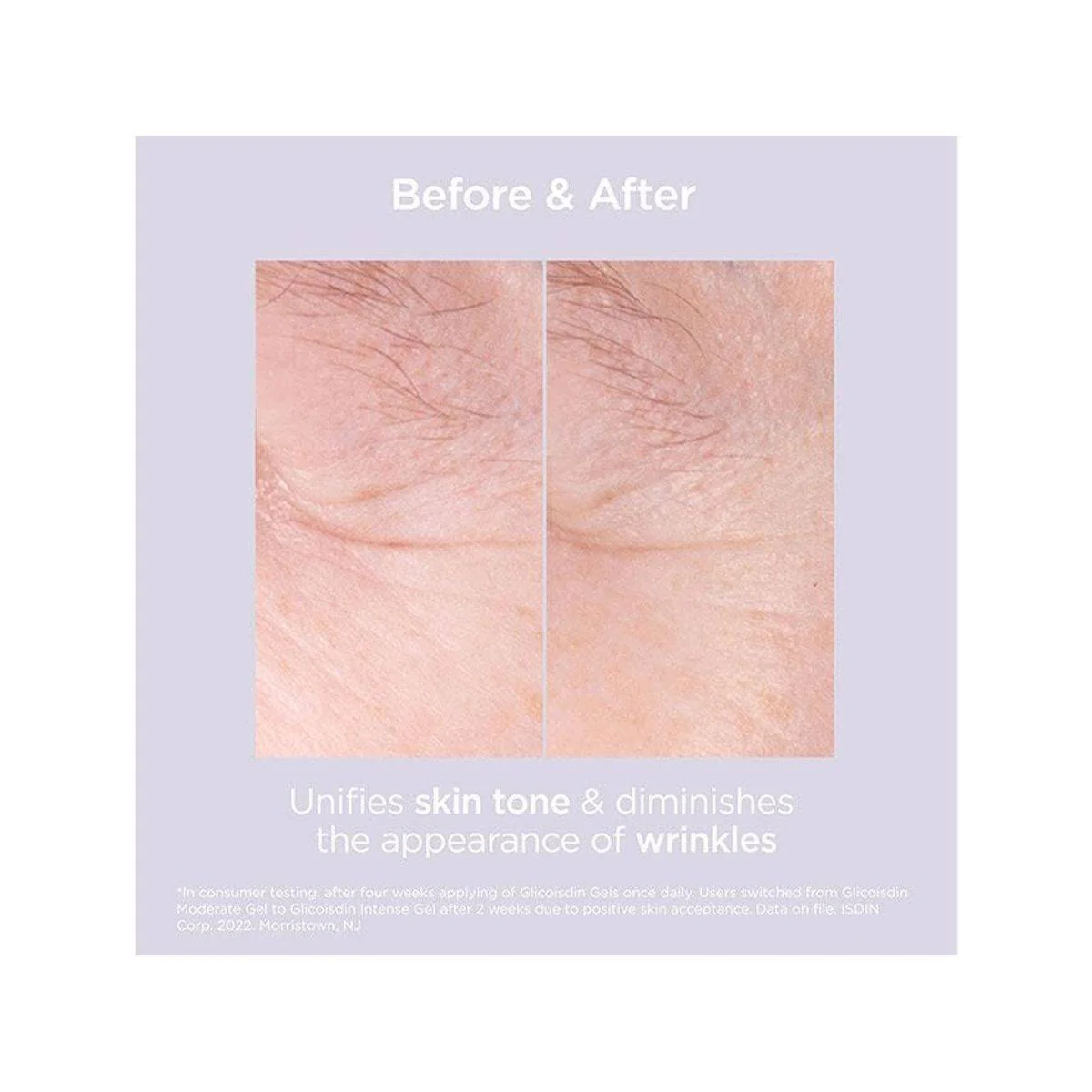 Isdin Isdinceutics Renew Glicoisdin 15 Moderate Facial Gel 50g - Image 6