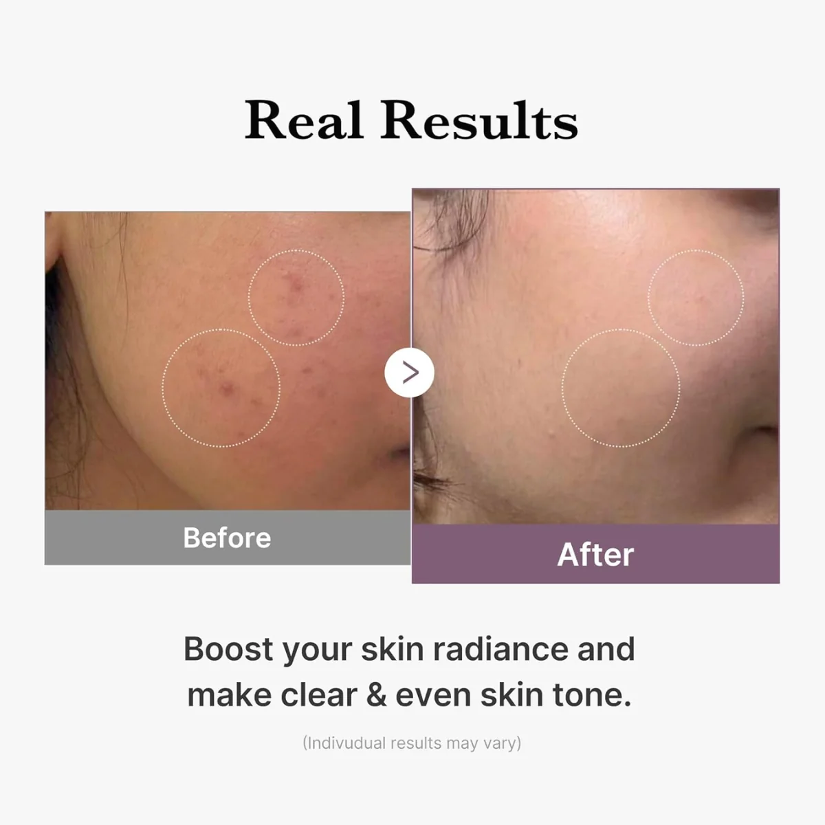 Medicube Age-R Glutathione Glow Toner 140ml - Image 6