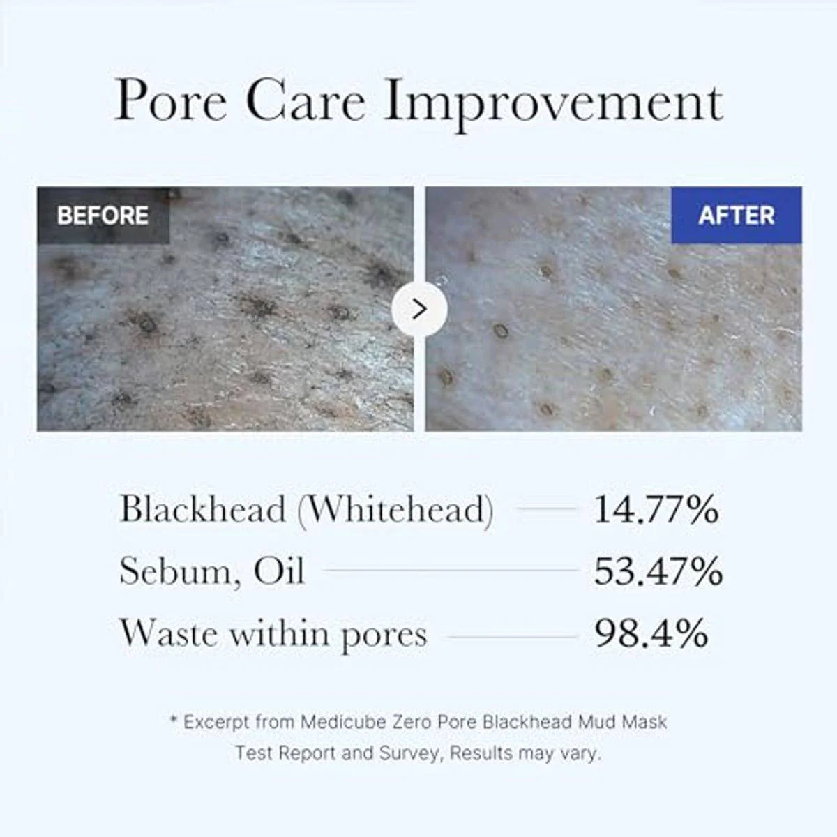 Medicube Zero Pore Blackhead Mud Mask 100g - Image 5