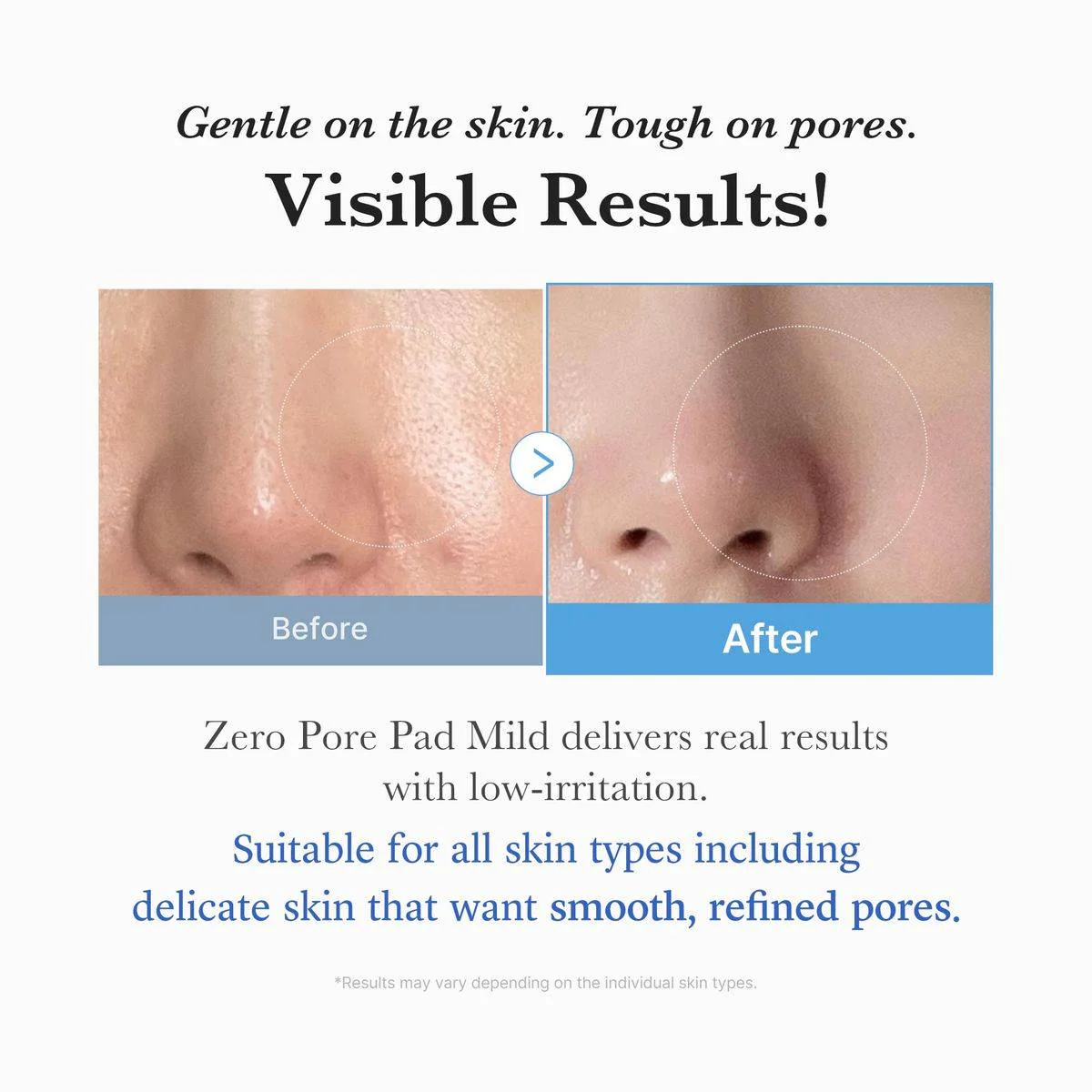 Medicube Zero Pore Pad Mild 70 Pads - Image 5