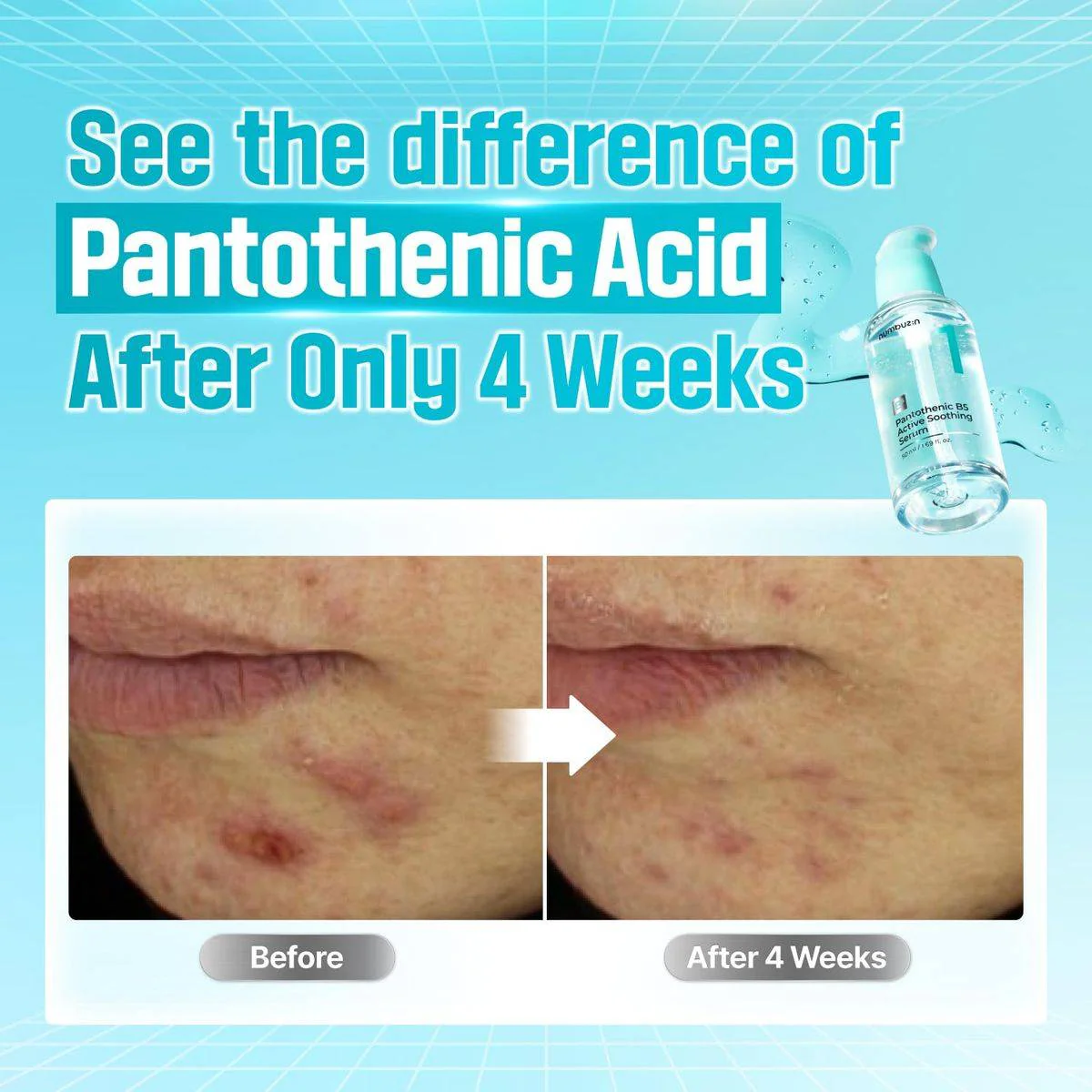 Numbuzin 1 Pantothenic B5 Active Soothing Serum 50ml - Image 3