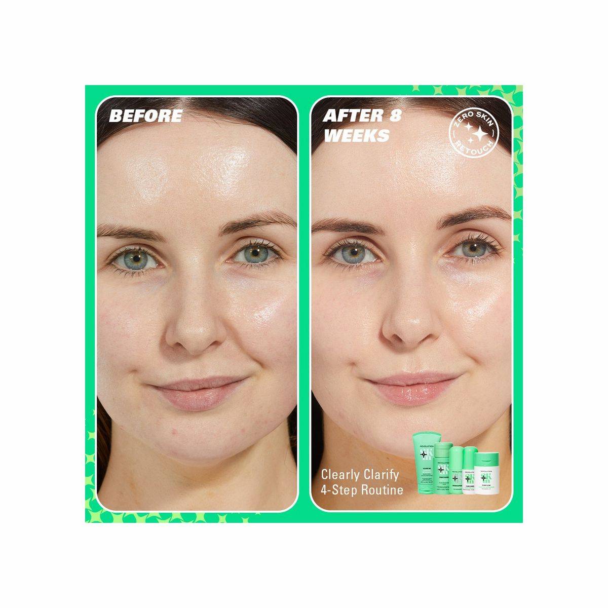 Revolution Skincare Clearly Clarify Starter Kit - Image 7