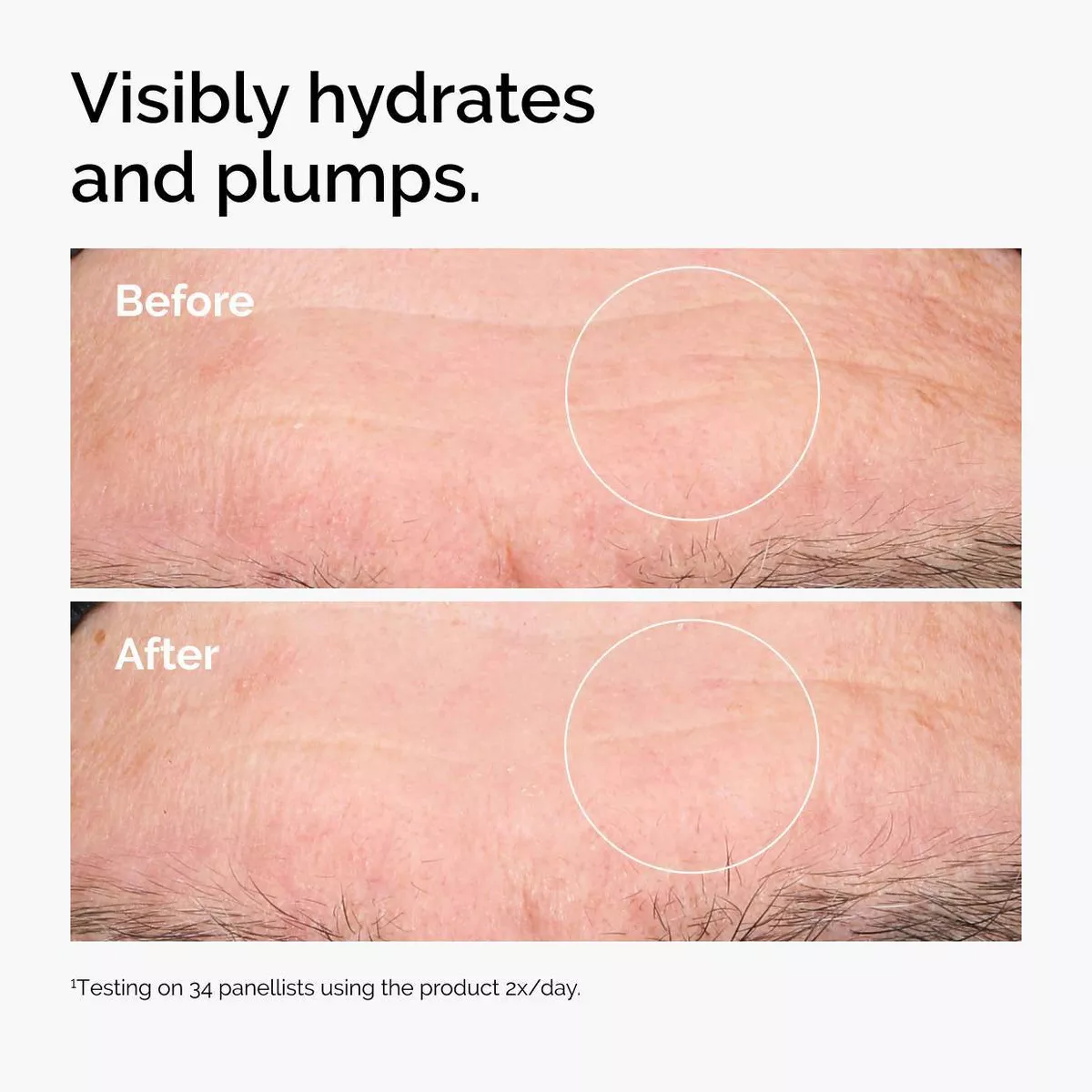 The Ordinary Hyaluronic Acid 2% + B5 120ml - Image 3