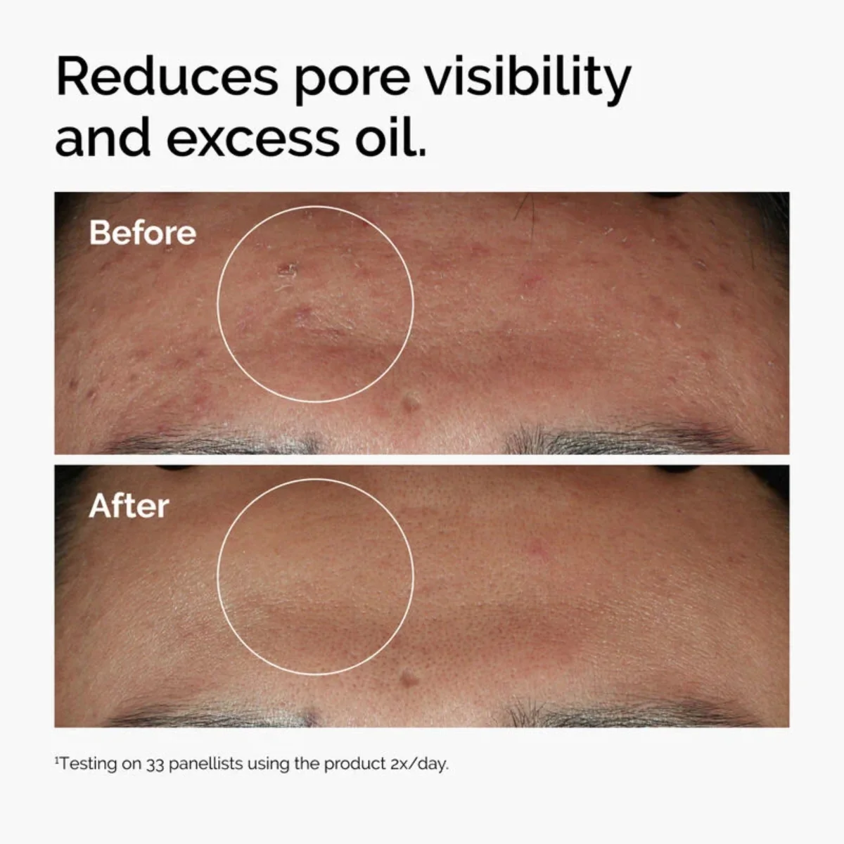 The Ordinary Niacinamide 10% + Zinc 1% Serum 120ml - Image 4