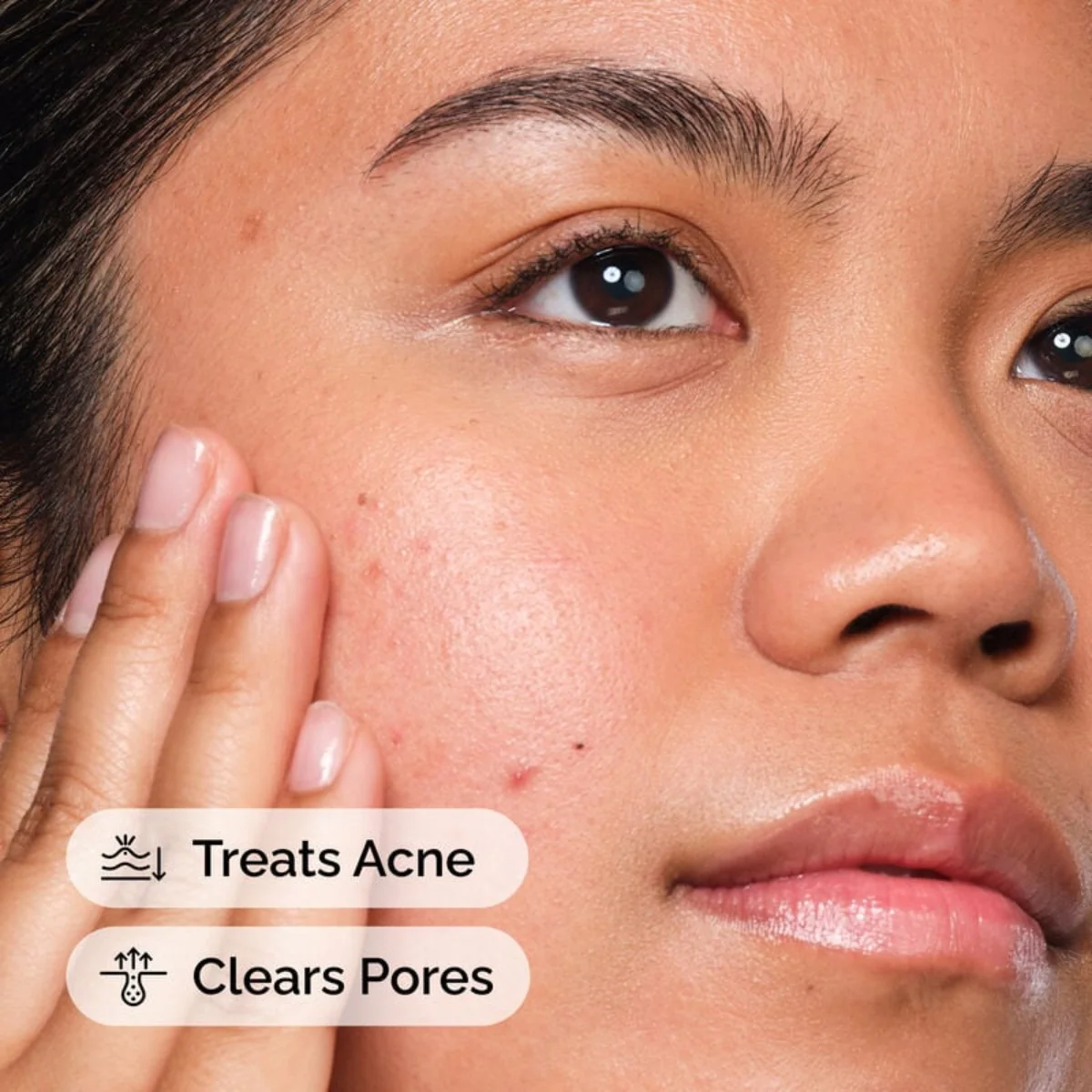 The Ordinary Salicylic Acid 2% Solution 30ml - Image 2